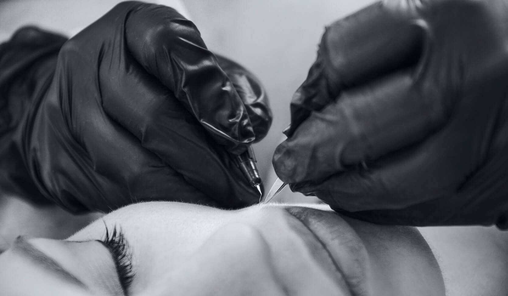 Results electrolysis - Face2Face Clinic | Helping trans women transition successfully