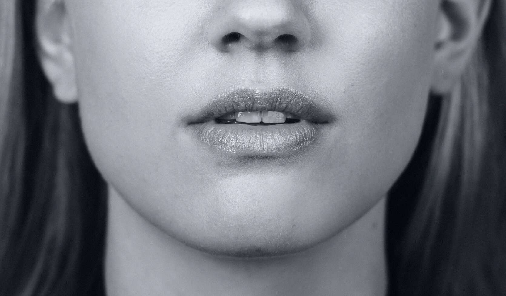 General conditions - Face2Face Clinic | Helping trans women transition successfully