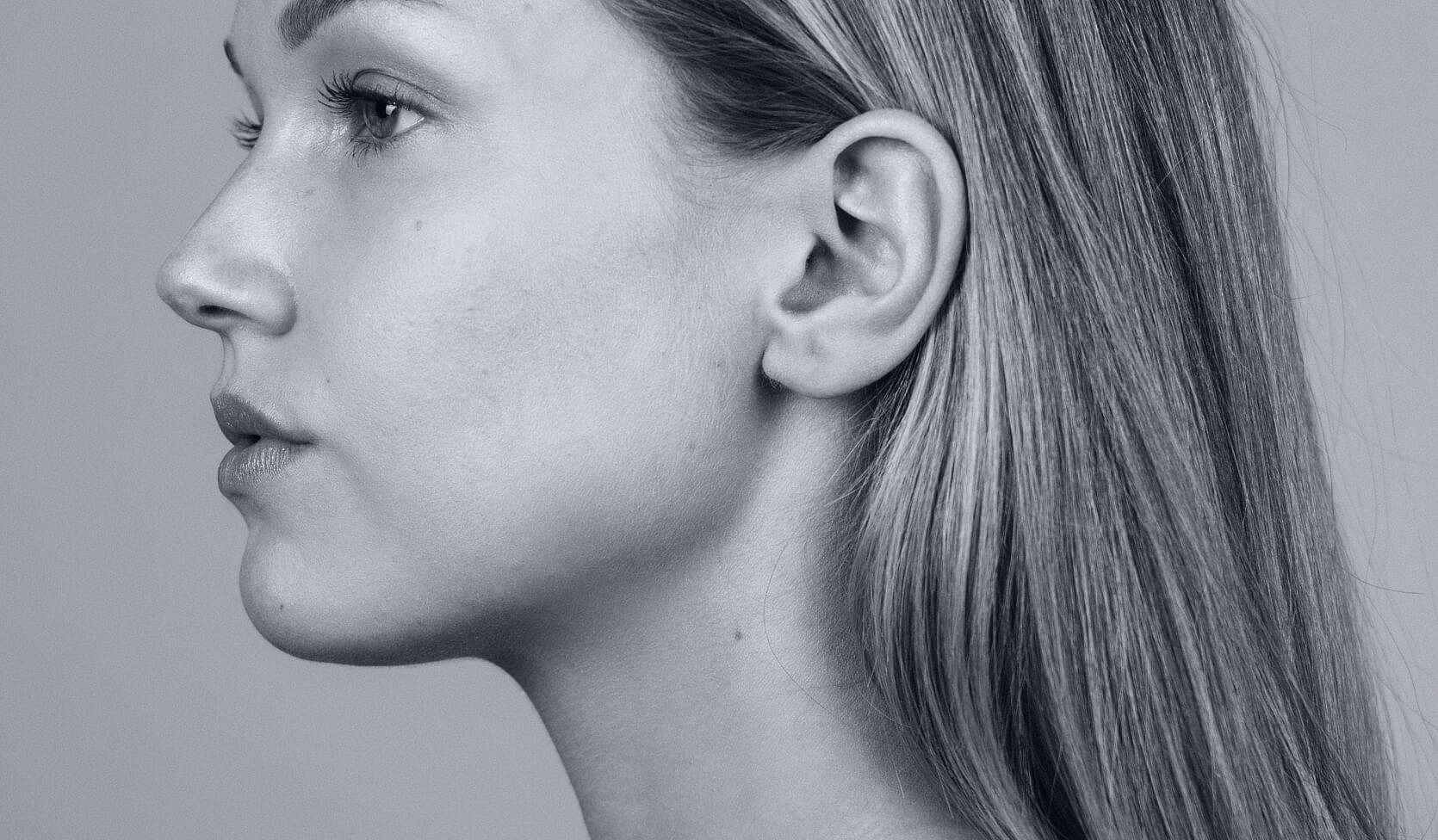 Elektrolyse - Face2Face Clinic | Wij helpen transvrouwen bij een succesvolle transitie