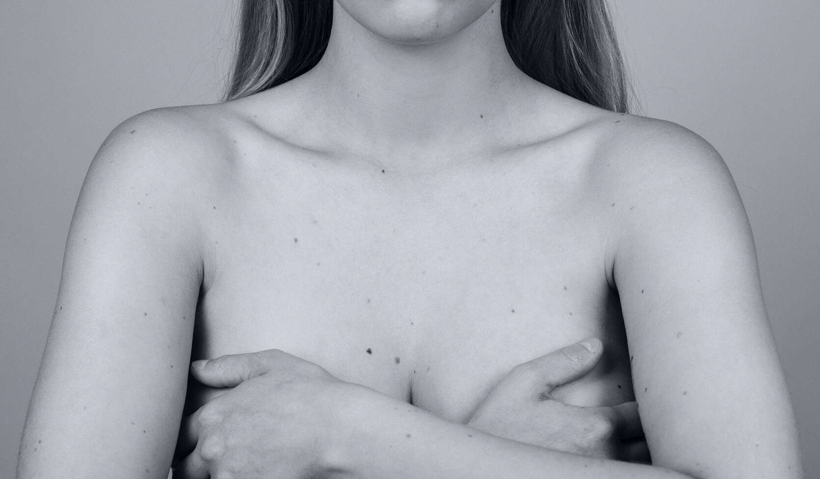 Get a quote - Face2Face Clinic | Helping trans women transition successfully